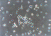 Figure 14 - Filament-producing yeasts of the Candida genus (Phase contrast microscopy × 400)