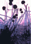 Figure 16 - Aspergillus niger conidial heads (× 100)