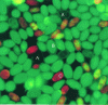 Figure 11 - Yeast: epifluorescence observation using acridine orange staining...