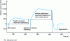 Figure 13 - Sensorgram obtained with a milk sample