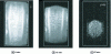 Figure 21 - MRI images of a core cylinder being frozen at – 30 °C