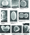 Figure 5 - Different types of pollen found in flowering plants (SEM)