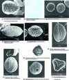 Figure 9 - Apertures of the most common pollens concentrated in honeys. Acetolysed pollens (figures a to g; i-j: SEM; h: Mph)