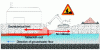 Figure 7 - Illustration of pollution source control in the unsaturated zone [5].