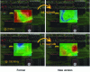 Figure 5 - Comparison of near-field EM emission at different frequencies around the old and new versions of the 1 MHz oscillator.