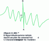 Figure 5 - EPR spectra of strawberry achenes