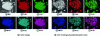 Figure 15 - Backscattered electron SEM image and EDS chemical mapping of Ti alloy0.30V0.25Zr0.10Nb0.25Mg0.10 before and after hydrogen absorption/desorption cycling [22]