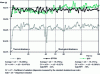 Figure 3 - Evolution of part mass during typical production of PBT-injected ISO specimens for the three control modes