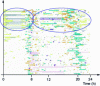 Figure 19 - Example of a spatio-temporal diagram of a subject with incipient dementia (more intense nocturnal activity with visits to the bathroom and kitchen).