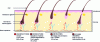 Figure 4 - Hair cycle of a pilosebaceous follicle [11].