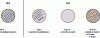 Figure 5 - Different types of solid lipid nanoparticles SLN and NLC