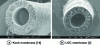 Figure 13 - Hollow-fiber membrane 