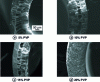 Figure 16 - Influence of additive concentration (5 to 20% by weight PVP) on the structuring of PEEK/DMF hollow fibers [55].