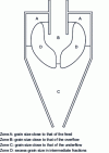 Figure 6 - Particle size distribution in a hydrocyclone [15].