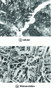 Figure 2 - As-cast structures for unalloyed steel castings