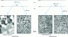 Figure 34 - Modification of the quenched structure of two cast structural steels by intercritical treatment at "ideal" temperature to optimize mechanical properties after final tempering [37]