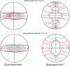 Figure 25 - Influence of annealing on tube texture