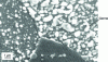 Figure 16 - Micrograph of a mild steel surface in the early stages of electro-galvanizing (source: A. Khélifa, University of Blida, Algeria).