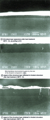 Figure 20 - Effect of heat treatment on hard chromium deposits obtained from trivalent chromium