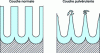 Figure 8 - Powdering phenomenon