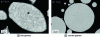 Figure 12 - Optical images (after etching) of Ag powder cross-section for cold spray(doc. MINES ParisTech, G. Rolland)