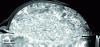 Figure 22 - Dark-field transmission electron microscopy (TEM) image of a thin titanium particle blade, in cross-section, after cold spray impact on TA6V titanium alloy (doc. MINES ParisTech, D. Giraud)