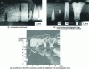 Figure 15 - Microdensitometric image of an autoradiograph showing tritium enrichment at weld beads on the surface of an AISI 316 L steel sample after laser treatment 