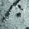 Figure 11 - Aging carbides on a dislocation observed by transmission electron micrography