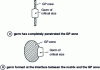 Figure 10 - Possible patterns of heterogeneous germination of a precipitate on a GP zone 