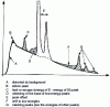 Figure 12 - Common artifacts in EDS analysis