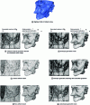 Figure 17 - Example of a surface tile mesh: Voltaire's face (provided by École Nationale Supérieure des Télécommunications (ENST))