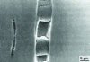 Figure 11 - Fragmentation damage to a manganese sulfide inclusion in austenitic stainless steel (from 40)