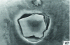 Figure 12 - Decohesive damage between an alumina inclusion and the matrix of a two-phase high-strength steel (after 40)