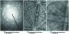 Figure 2 - Examples of TKP, BKP and ECP patterns.
The most striking feature is the regular arrangement of narrow stripes