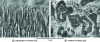 Figure 9 - Microstructure maps of a silver solder
sample after excessive etching by ion milling (“curtaining” in the
lower part of the specimen). Both images have been constructed off-line
from the backscattered electron intensity in the Kikuchi patterns.
The specimen was tilted at 70° out of the horizontal. It is worth
noting that TC and ZC could not be separated by conventional imaging
with a one-dimensional E-T detector