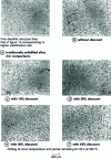 Figure 8 - Microstructures of cast AS 7 G 03 alloys, after thickness reduction by cold rolling followed by partial remelting