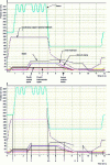 Figure 33 - Detailed kinematics