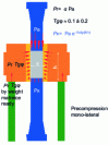 Figure 9 - Example of single-lateral precompression