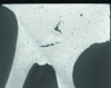Figure 15 - Shrinkage in the area of a solid part (tomographic section) (photo credit: CTIF)
