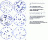 Figure 2 - Different graphite shapes according to standard NF EN ISO 945-1-May 2009