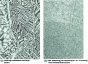 Figure 4 - Structures observed at magnification 100 of a CuAl9Fe3 as-cast in a permanent mold (after [3]).
