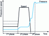 Figure 21 - Speed/pressure vs. time diagram for a conventional three-phase machine