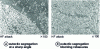 Figure 42 - Indirect squeeze casting: eutectic segregation in an AlSi10Mg casting (Pechiney document)