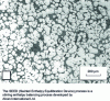 Figure 43 - Globular structure of an AlSi7Mg0.6 prepared by the SEED process