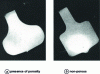 Figure 8 - Evolution of a blank profile with the pressing operation