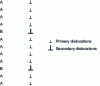 Figure 25 - Correlation between the description of a grain boundary structure in terms of intrinsic dislocations and its description in terms of structural units A and B