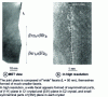 Figure 3 - High-resolution TEM observation of a nickel bicrystal