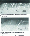 Figure 15 - Electron micrographs showing accommodation of several extrinsic dislocations in a Σ = 11 {332} nickel joint [45]