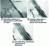 Figure 20 - Instantaneous incorporation of a dislocation at the head of a stack on a general copper joint [47].