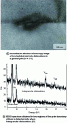 Figure 32 - Analysis of the yttrium content of two regions of a general grain boundary of an MgO-doped, Y2O3-codoped alumina shows that yttrium preferentially segregates on extrinsic dislocations revealed by transmission electron microscopy[81].